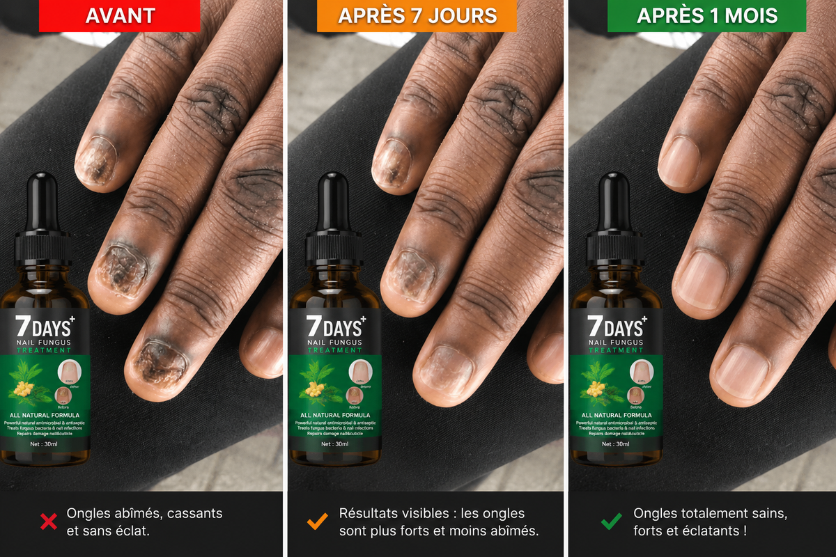 7 Days Serum — Transformez vos ongles abîmés en seulement une semaine !