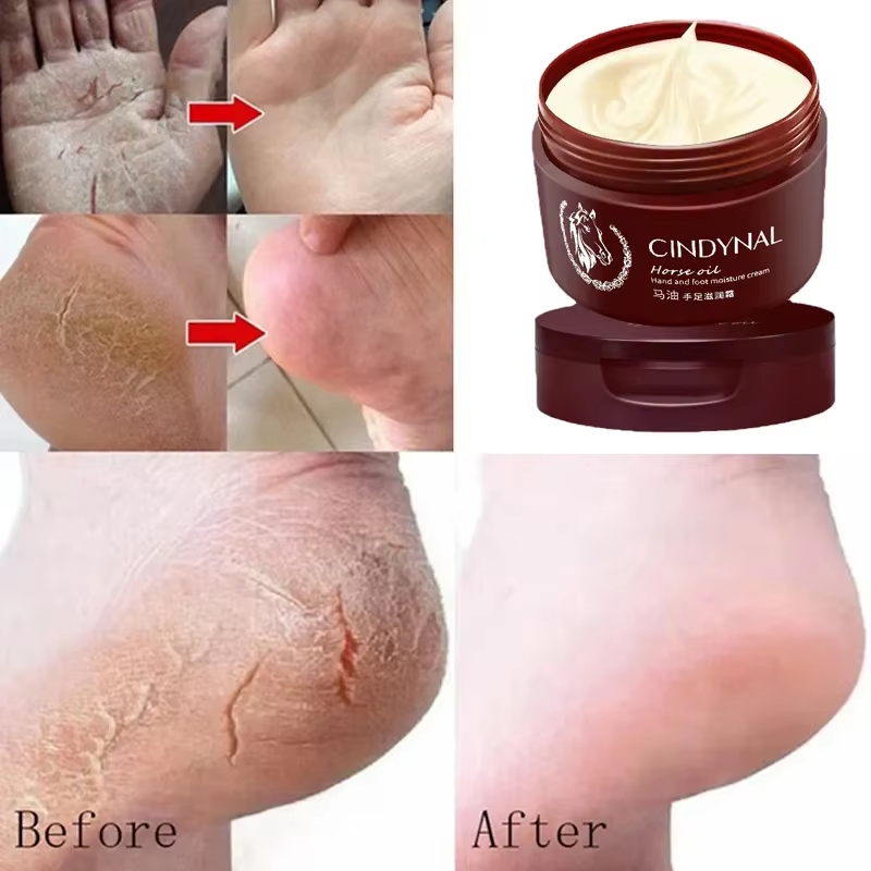Crème Réparatrice pour Talons Fissurés & Peau Rugueuse