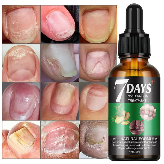 7 Days Serum — Transformez vos ongles abîmés en seulement une semaine !