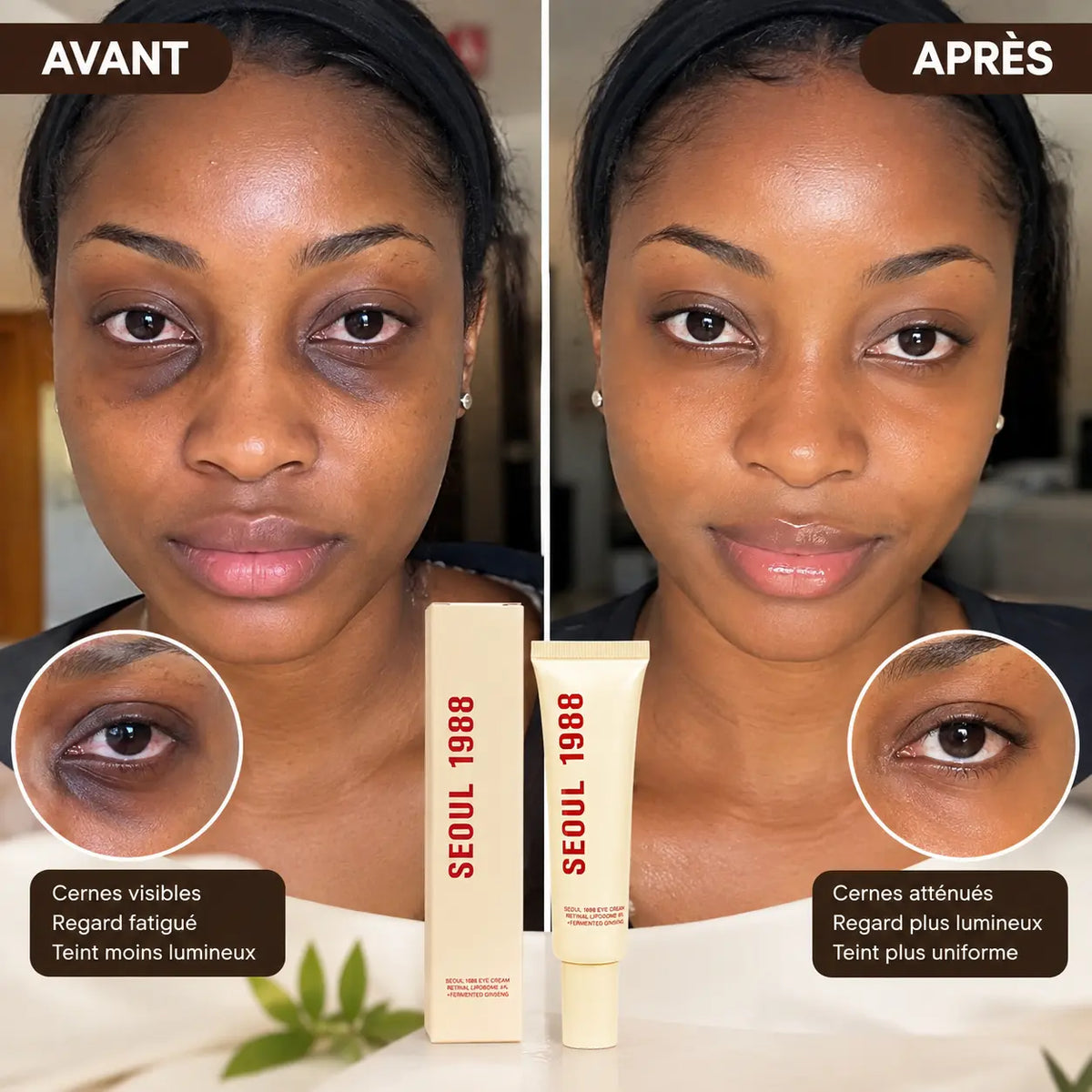Cernes foncés, yeux fatigués : redonnez de la lumière à votre regard.
